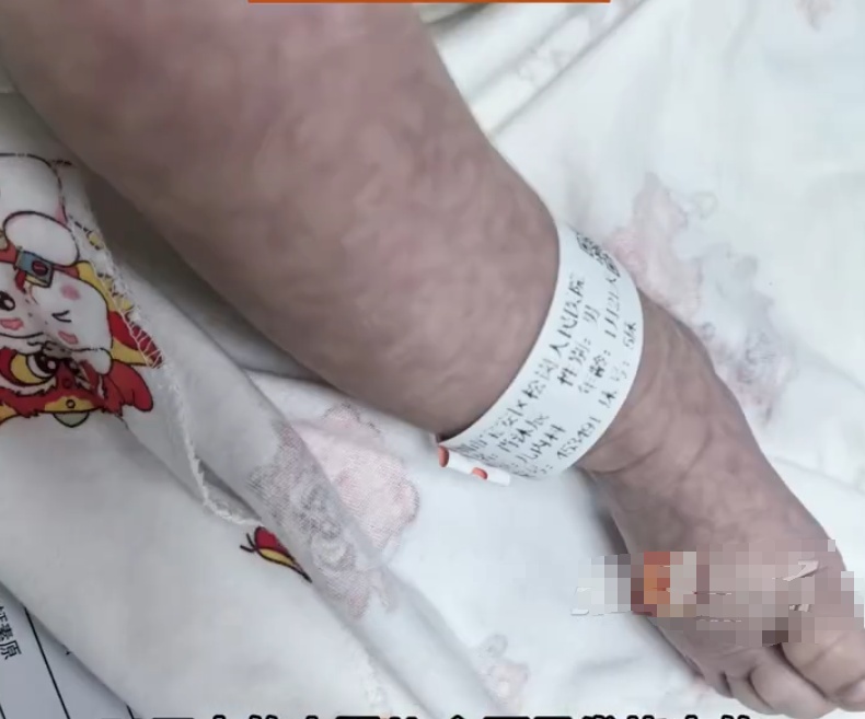 2个月婴儿身体布满"花纹"…发烧后,爸爸这个操作太害人! 2个月婴儿身体布满"花纹"…发烧后,爸爸这个操作太害人!