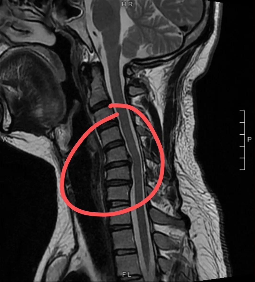 杭州多名网友中招，清一色都是年轻人：赶紧趁早改