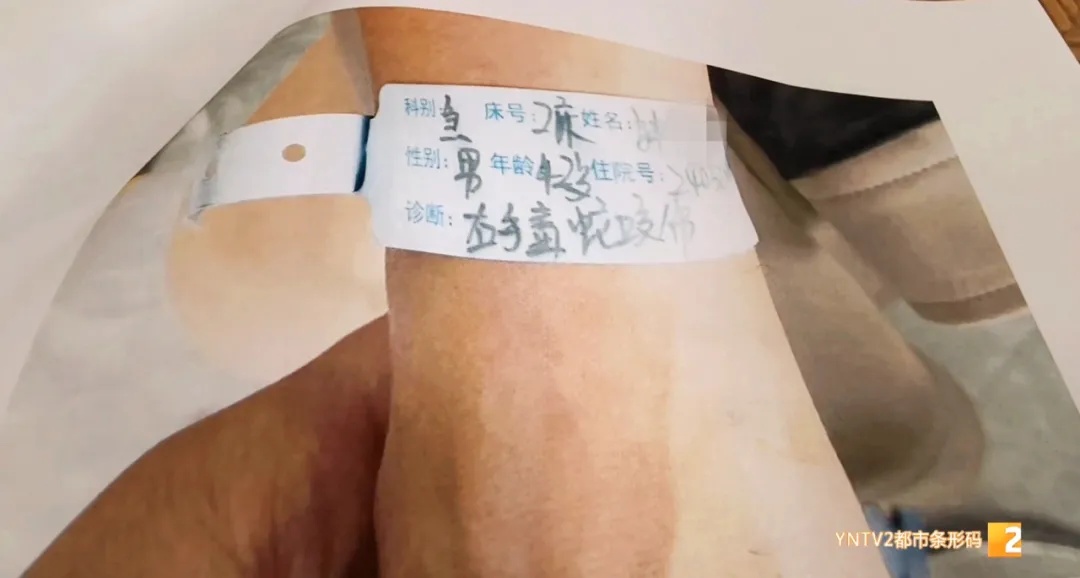 被蛇咬伤可以申请赔偿！这样操作