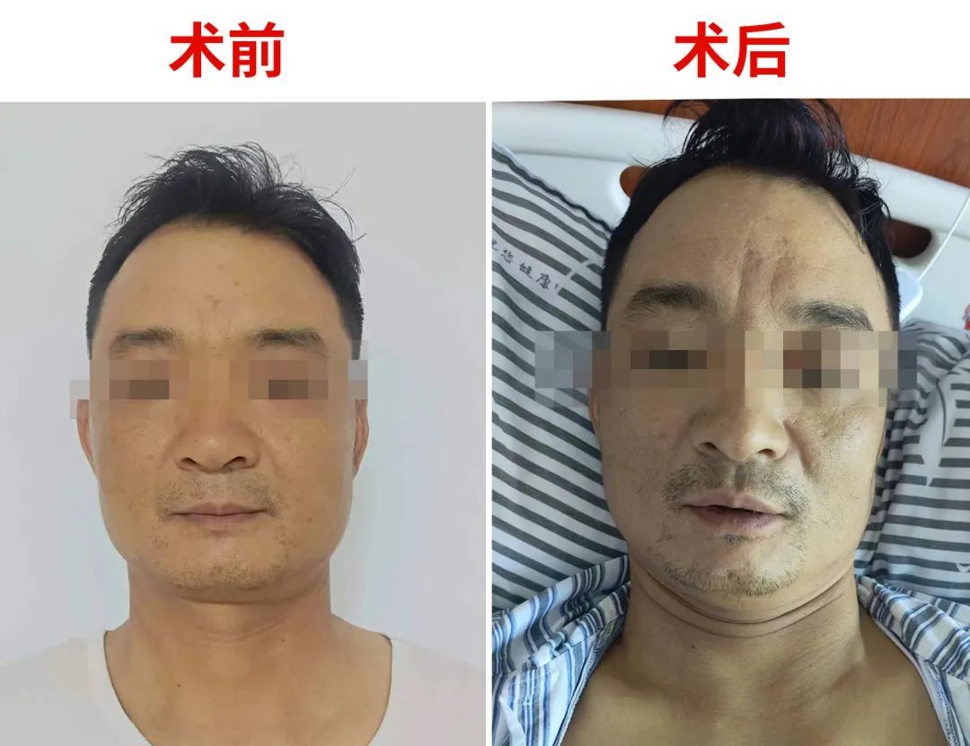 男子腹痛过后惊变“小黄人”,原来是“它”惹的祸…… 男子腹痛过后惊变“小黄人”,原来是“它”惹的祸……