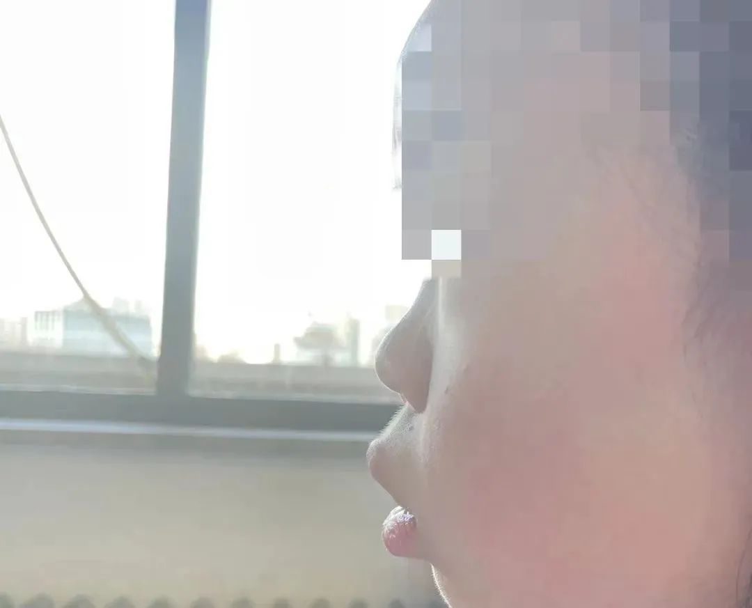 这病会让人越长越丑、还影响智力！瑞金医院近期频繁接诊，紧急提醒