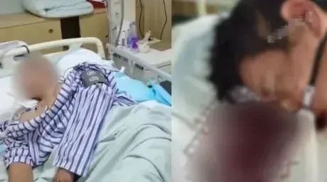 一男子紧急送入ICU,“吐血成植物人”!高温预警信号生效中,请注意→ 一男子紧急送入ICU,“吐血成植物人”!高温预警信号生效中,请注意→