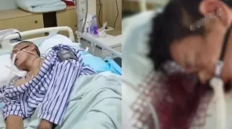 命悬一线！男子吐血成植物人！医生紧急提醒