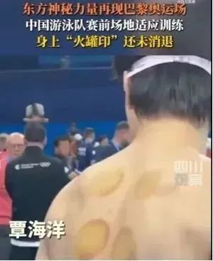 奥运会再现“神秘的东方力量”，中国运动员参赛贴肚脐贴、拔火罐