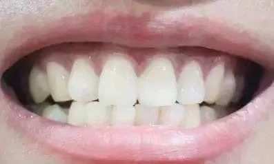 三个动作+一个食谱？比吃药都有用的专家私藏的补肾小方！