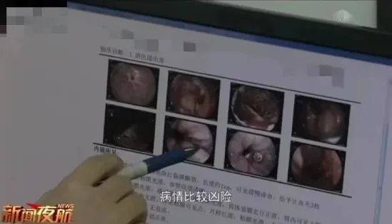 男子一口气喝完冰镇饮料后,吐血1000毫升!医生紧急提醒…… 男子一口气喝完冰镇饮料后,吐血1000毫升!医生紧急提醒……