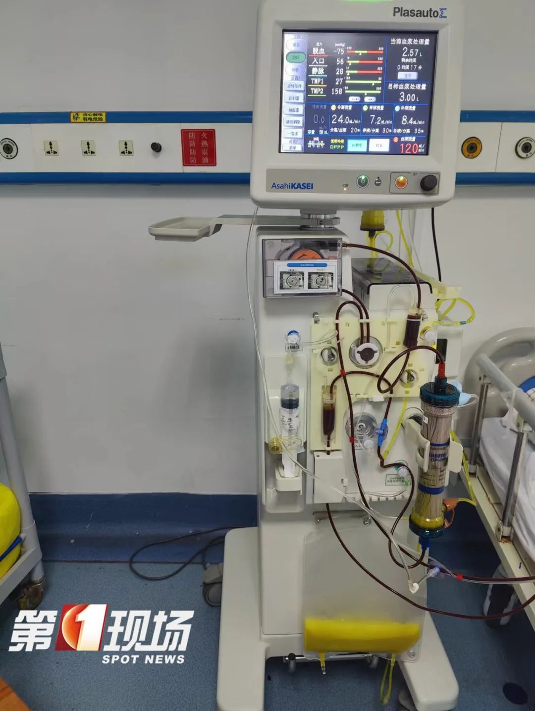 多项指标“爆表”，深圳男子抽血抽出绿色血液！别再这么干了……