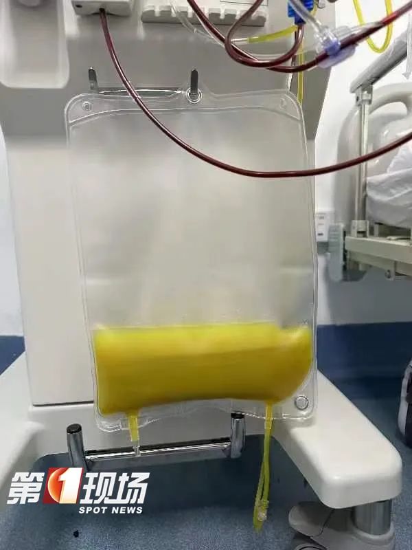 多项指标“爆表”，深圳男子抽血抽出绿色血液！别再这么干了……