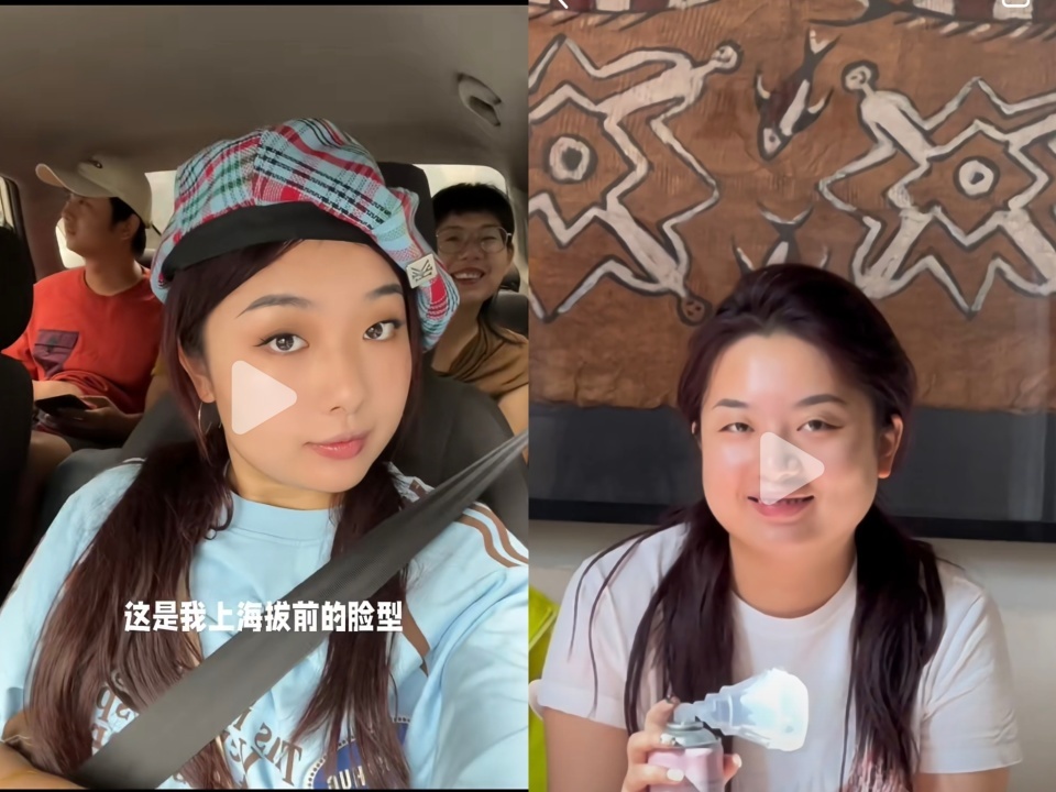 网红博主高反后“肿”若两人，医生：可以预防！