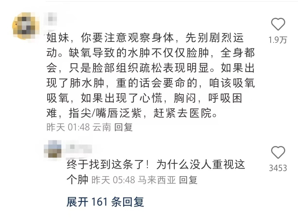 网红博主高反后“肿”若两人，医生：可以预防！