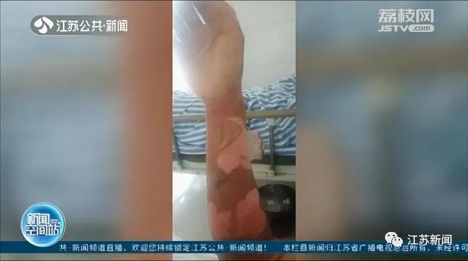 警惕！“一喷就结冰”的它，使用不慎就会变成一颗“燃烧弹”