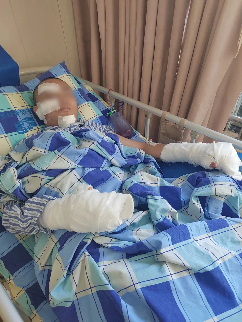 “半夜敲门二话不说就砍”!17岁准大学生旅游期间在酒店被砍伤,重庆警方通报 “半夜敲门二话不说就砍”!17岁准大学生旅游期间在酒店被砍伤,重庆警方通报