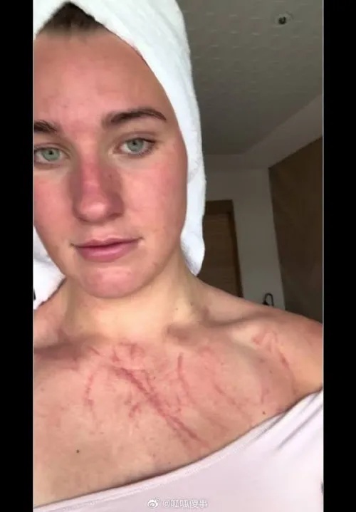 胸口全是血痕！中国女将霸气回怼：谁也别说谁！