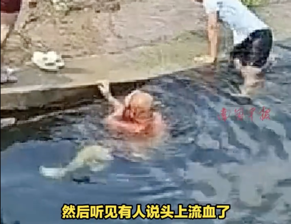 男子头部流血不止，还有人四肢瘫痪！这项我国奥运王牌项目，别轻易模仿！