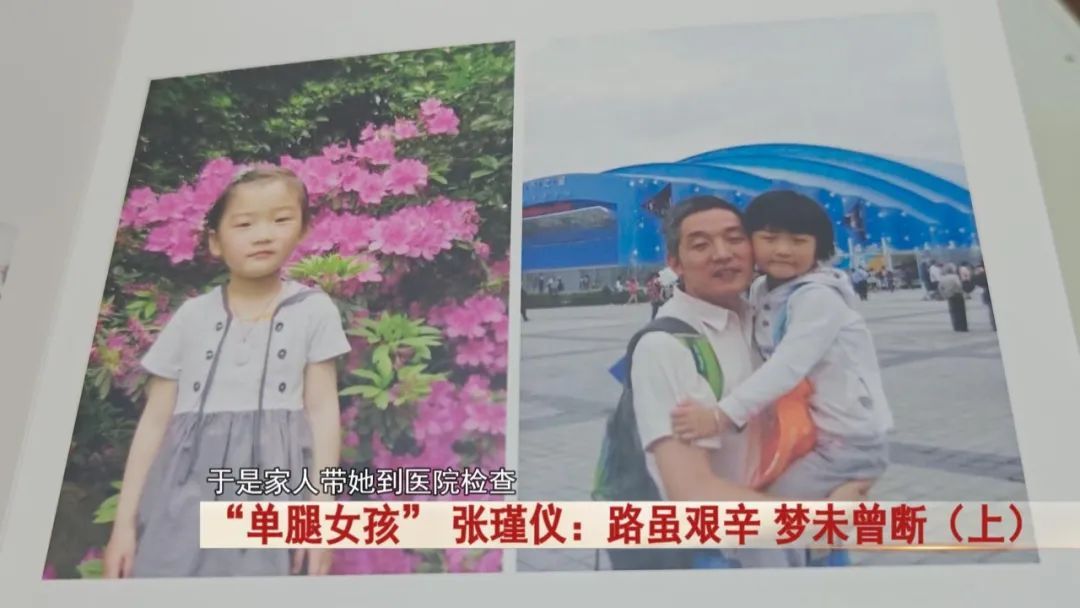 “单腿女孩” 张瑾仪！先后手术11次，化疗11次，如今被这所学校录取！