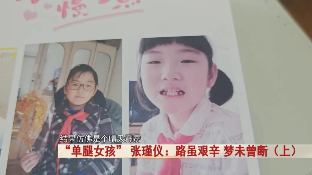 “单腿女孩” 张瑾仪！先后手术11次，化疗11次，如今被这所学校录取！