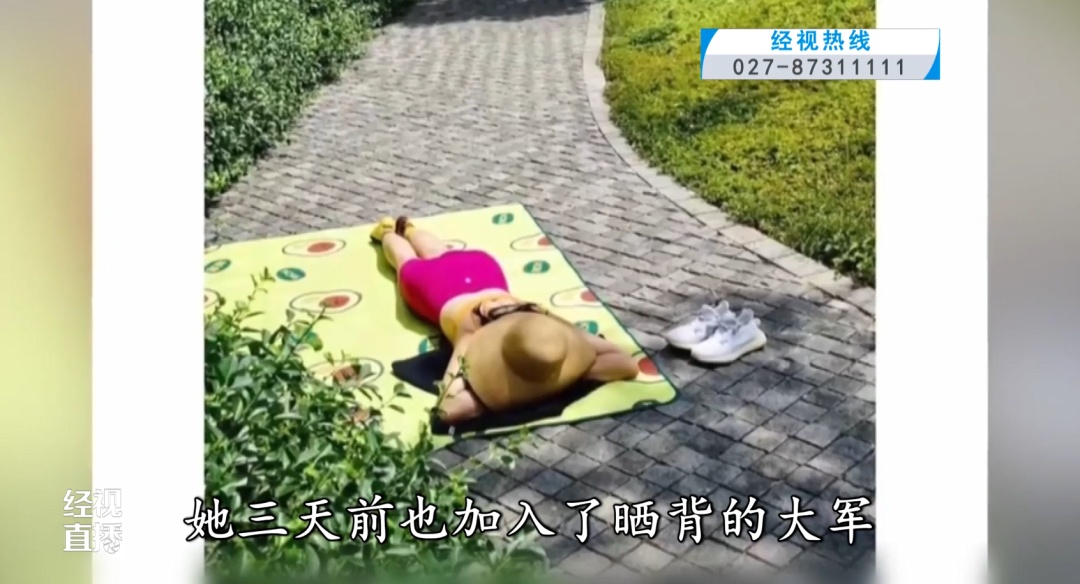 三伏天晒背火了！武汉一女子却因此进了医院......医生提醒！