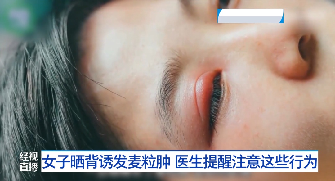 三伏天晒背火了！武汉一女子却因此进了医院......医生提醒！