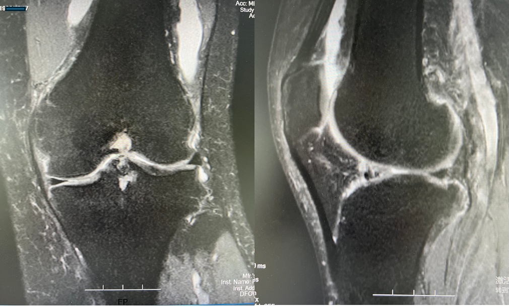 这项运动，阜城年轻人很“上头”！市医院重要提醒！