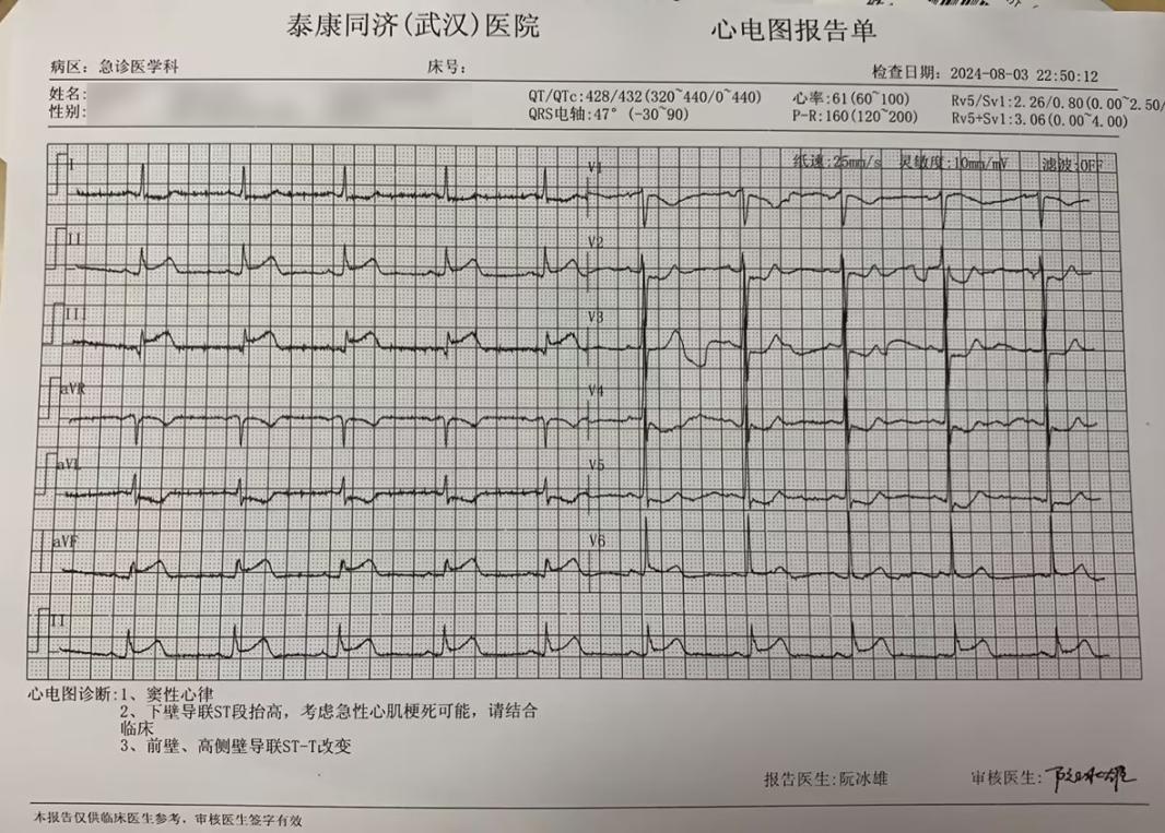 男子酒后突然喉咙痛，竟是心梗？医生提醒……