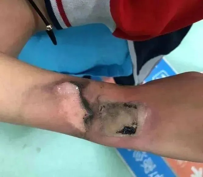 “安全神器”不安全?儿童智能手表存在隐患→ “安全神器”不安全?儿童智能手表存在隐患→