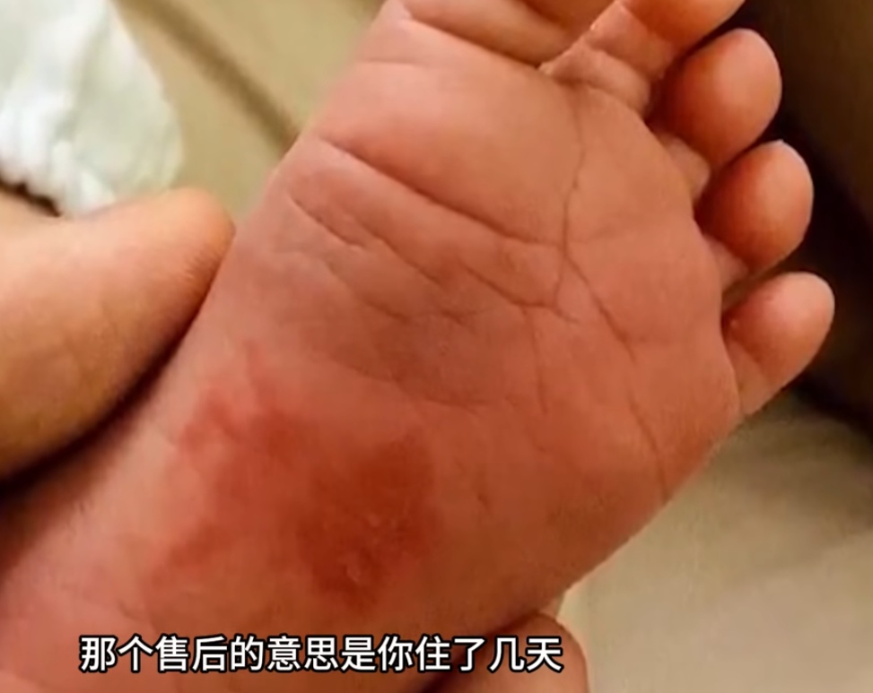 上海一宝妈怒了！月嫂用指甲抠破12天大的婴儿脚底