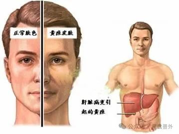 为什么病房里有这么多小黄人？