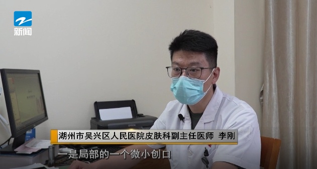 女子做美甲感染HPV!医生提醒 女子做美甲感染HPV!医生提醒