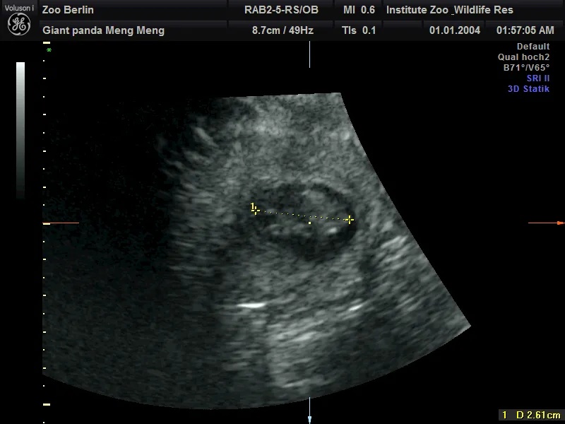 喜讯确认：再次怀上双胞胎