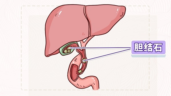 久坐不动、大鱼大肉,小心这种富贵病! 久坐不动、大鱼大肉,小心这种富贵病!