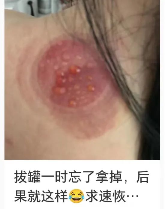 爆火！浙江男子跟风半小时，家人一看吓傻眼！警惕：这事有讲究