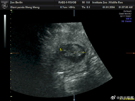 旅德大熊猫“梦梦”双胞胎B超照