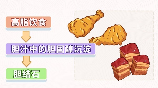 久坐不动、大鱼大肉,小心这种富贵病! 久坐不动、大鱼大肉,小心这种富贵病!