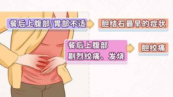 久坐不动、大鱼大肉,小心这种富贵病! 久坐不动、大鱼大肉,小心这种富贵病!