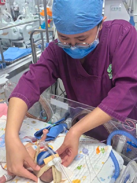 孕妇意外分娩，护士万米高空抢救25周手掌宝宝