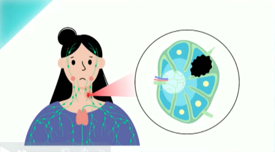 皮肤出现这几个特征，医生建议你去查查血
