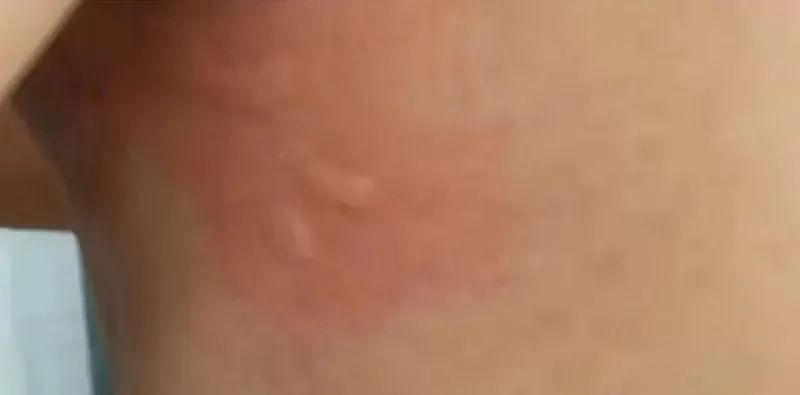 深圳海滩惊现剧毒水母!被蛰伤严重可致命! 深圳海滩惊现剧毒水母!被蛰伤严重可致命!