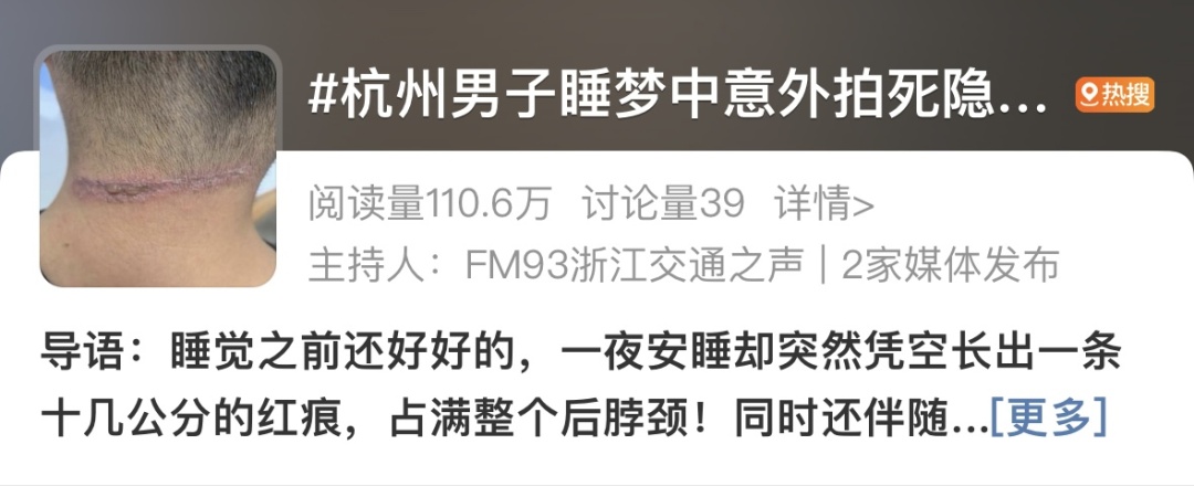 拍死一只虫，竟可能毁容！这个季节应高度警惕！