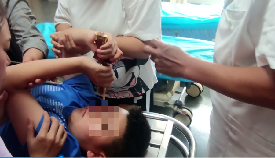 引以为戒！金属玩具枪刺入男孩眼部→