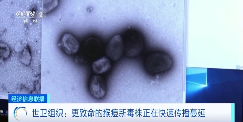 猴痘已致537人死亡！最高级别疫情警报