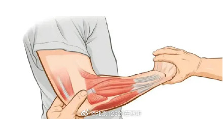 “网球肘”有哪些症状? “网球肘”有哪些症状?