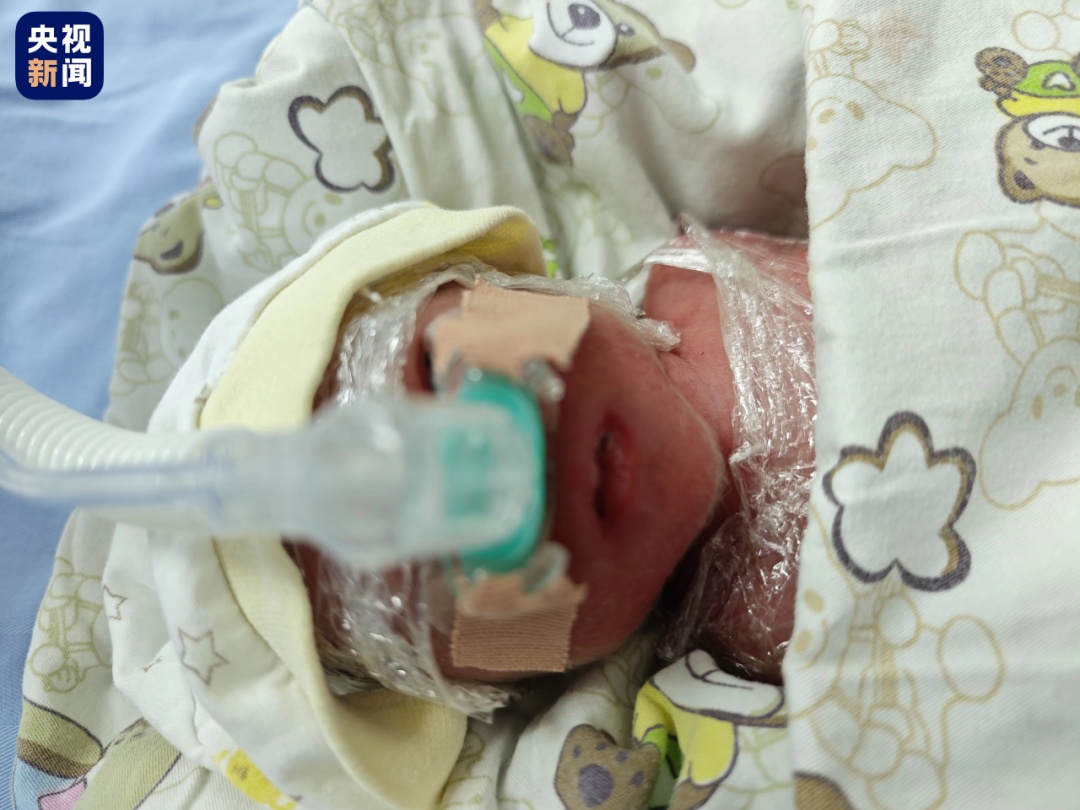 体重：820克，出生地：万米高空！