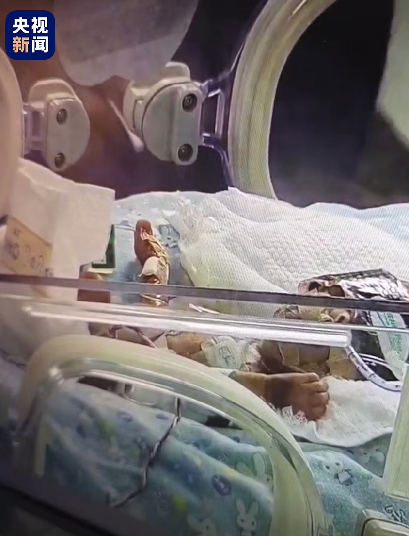 体重:820克,出生地:万米高空!飞机紧急迫降长沙 体重:820克,出生地:万米高空!飞机紧急迫降长沙