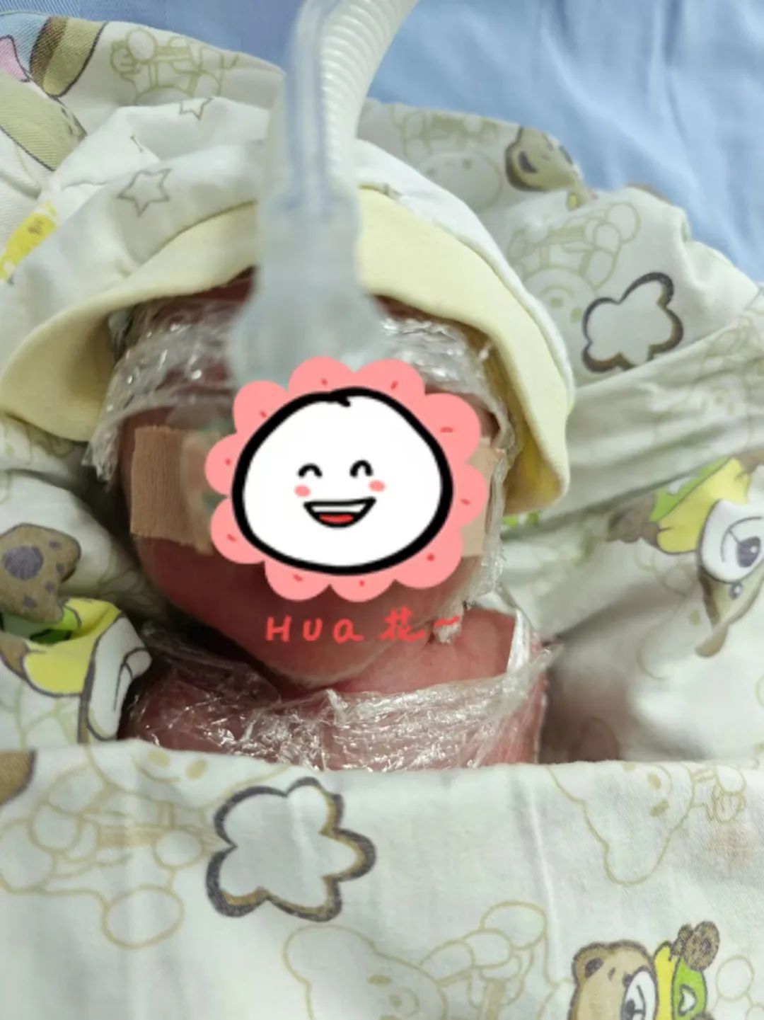 紧急！25周超早产儿飞机上意外出生！幸运的是……