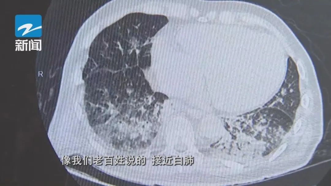 后悔啊！7岁女孩突然变“白肺”！很多人都用错了…医生建议要这样用