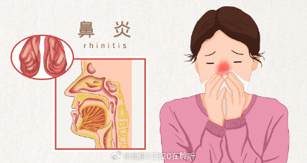 从中医角度看，过敏性鼻炎常见哪些类型？