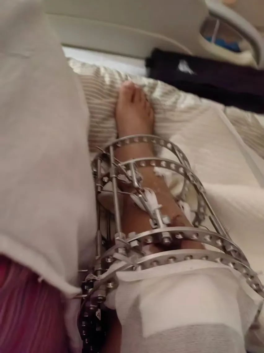 所有不幸都来自身高？“断骨增高”后的人：没有一天不后悔