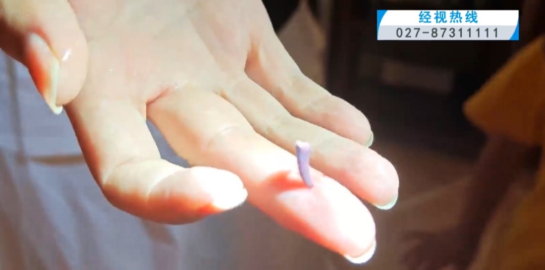 “喂,119吗?我手指被螃蟹夹住了!”湖北一女子报警后,消防员们愣住了…… “喂,119吗?我手指被螃蟹夹住了!”湖北一女子报警后,消防员们愣住了……