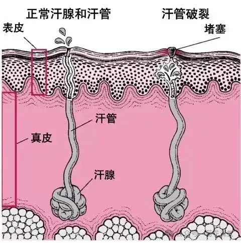 杭州男子总被妻子嫌弃滂臭，一查真有大病！