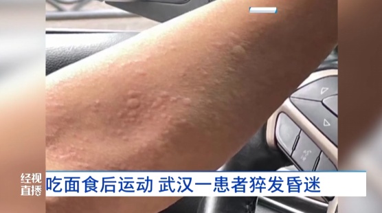 吃面食后运动,武汉一男子猝发昏迷!医生提醒:这类人要注意 吃面食后运动,武汉一男子猝发昏迷!医生提醒:这类人要注意